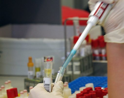 Denně vyšetříme desítky vzorků na protilátky proti spalničkám