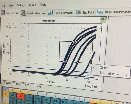 Zákulisí laboratoře molekulární biologie: Vyšetření PCR na přítomnost viru COVID-19